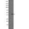 Chemerin Chemokine-Like Receptor 1 antibody, abx147518, Abbexa, Western Blot image 