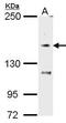 Transient Receptor Potential Cation Channel Subfamily M Member 7 antibody, PA5-28101, Invitrogen Antibodies, Western Blot image 