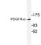 Platelet Derived Growth Factor Receptor Alpha antibody, LS-C176549, Lifespan Biosciences, Western Blot image 