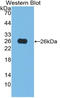 ATF4 antibody, LS-C292622, Lifespan Biosciences, Western Blot image 