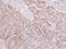 Nucleotide exchange factor SIL1 antibody, NBP2-20364, Novus Biologicals, Immunohistochemistry paraffin image 