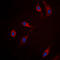 RRAD, Ras Related Glycolysis Inhibitor And Calcium Channel Regulator antibody, LS-C352807, Lifespan Biosciences, Immunofluorescence image 