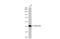 Beta-Actin antibody, GTX134932, GeneTex, Western Blot image 