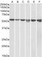 Phosphatidylethanolamine Binding Protein 4 antibody, 42-236, ProSci, Enzyme Linked Immunosorbent Assay image 