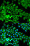 Junction Plakoglobin antibody, STJ24277, St John