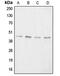 Aggrecan antibody, MBS822299, MyBioSource, Western Blot image 