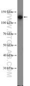 Cadherin 3 antibody, 13773-1-AP, Proteintech Group, Western Blot image 