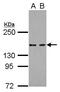 Lysine-specific demethylase 6A antibody, GTX120873, GeneTex, Western Blot image 