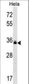 Lectin, Mannose Binding 2 antibody, LS-C165805, Lifespan Biosciences, Western Blot image 