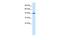 Zona Pellucida Glycoprotein 3 antibody, PA5-41135, Invitrogen Antibodies, Western Blot image 