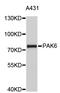 P21 (RAC1) Activated Kinase 6 antibody, STJ24891, St John