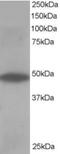 Oxysterol Binding Protein Like 1A antibody, NB100-1331, Novus Biologicals, Western Blot image 