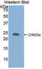 Collagen Type XVIII Alpha 1 Chain antibody, LS-C293450, Lifespan Biosciences, Western Blot image 