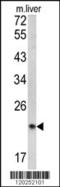 Signal Peptidase Complex Subunit 3 antibody, MBS9206024, MyBioSource, Western Blot image 