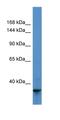 Transient Receptor Potential Cation Channel Subfamily M Member 8 antibody, orb329830, Biorbyt, Western Blot image 