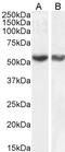 Ring Finger Protein 8 antibody, 46-313, ProSci, Enzyme Linked Immunosorbent Assay image 