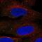 Transmembrane Protein 68 antibody, NBP1-82000, Novus Biologicals, Immunofluorescence image 