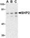 Protein Tyrosine Phosphatase Non-Receptor Type 11 antibody, TA306350, Origene, Western Blot image 