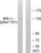 Insulin Receptor Substrate 1 antibody, LS-C199143, Lifespan Biosciences, Western Blot image 