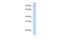 Amine Oxidase Copper Containing 2 antibody, GTX46578, GeneTex, Western Blot image 