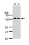 NPR-A antibody, LS-C109432, Lifespan Biosciences, Western Blot image 