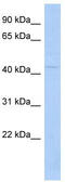 TSPY Like 6 antibody, TA336192, Origene, Western Blot image 