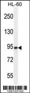 Endo-Beta-N-Acetylglucosaminidase antibody, MBS9214338, MyBioSource, Western Blot image 