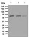 FYN Proto-Oncogene, Src Family Tyrosine Kinase antibody, ab125016, Abcam, Western Blot image 