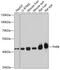 Thyroid Hormone Receptor Beta antibody, GTX16393, GeneTex, Western Blot image 