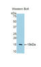 CD59 Molecule (CD59 Blood Group) antibody, LS-C314245, Lifespan Biosciences, Western Blot image 