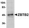 Zinc Finger And BTB Domain Containing 2 antibody, orb75118, Biorbyt, Western Blot image 