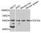 Suppressor Of Cytokine Signaling 4 antibody, A09261, Boster Biological Technology, Western Blot image 