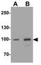 AKAP4 antibody, GTX31595, GeneTex, Western Blot image 