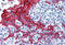Keratin 13 antibody, IQ291, Immuquest, Immunohistochemistry paraffin image 