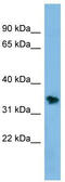 NSE1 Homolog, SMC5-SMC6 Complex Component antibody, TA330503, Origene, Western Blot image 