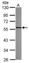 Glutamic--Pyruvic Transaminase antibody, NBP2-16731, Novus Biologicals, Western Blot image 