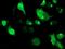 SSRA antibody, MA5-25635, Invitrogen Antibodies, Immunocytochemistry image 