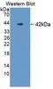 NPHS1 Adhesion Molecule, Nephrin antibody, abx131379, Abbexa, Western Blot image 