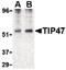 Perilipin 3 antibody, LS-B2539, Lifespan Biosciences, Western Blot image 