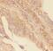 GLI Family Zinc Finger 1 antibody, PA5-79313, Invitrogen Antibodies, Immunohistochemistry paraffin image 