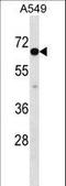 CLPTM1 Like antibody, LS-C168855, Lifespan Biosciences, Western Blot image 