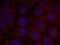 Insulin Like Growth Factor 1 Receptor antibody, PA5-37601, Invitrogen Antibodies, Immunofluorescence image 