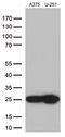 Transgelin 2 antibody, M05012, Boster Biological Technology, Western Blot image 