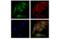 RAB5A, Member RAS Oncogene Family antibody, 46449S, Cell Signaling Technology, Immunocytochemistry image 