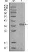 Nuclear Receptor Corepressor 1 antibody, M01304, Boster Biological Technology, Western Blot image 