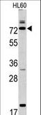 Calpain 9 antibody, LS-C100896, Lifespan Biosciences, Western Blot image 