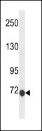 Chloride Intracellular Channel 6 antibody, LS-C157648, Lifespan Biosciences, Western Blot image 