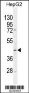Trimethyllysine Hydroxylase, Epsilon antibody, 55-385, ProSci, Western Blot image 
