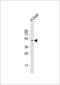Hepatocyte Nuclear Factor 4 Alpha antibody, 63-943, ProSci, Western Blot image 