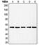 RAD23 Homolog B, Nucleotide Excision Repair Protein antibody, MBS820850, MyBioSource, Western Blot image 